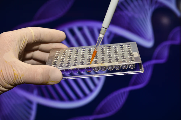 Genetics and Diabetes: an important factor in diabetes is family genetics. Image of clinical lab testing